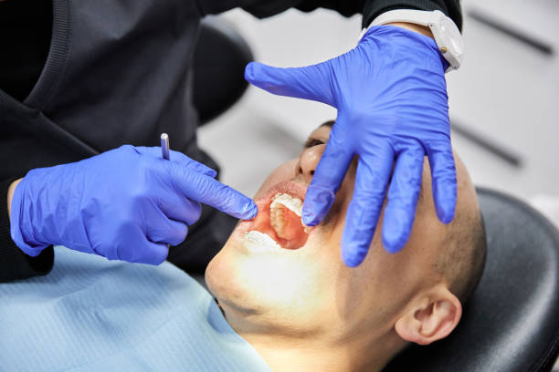 Best Emergency Treatment for Oral Infections in West Union, OH